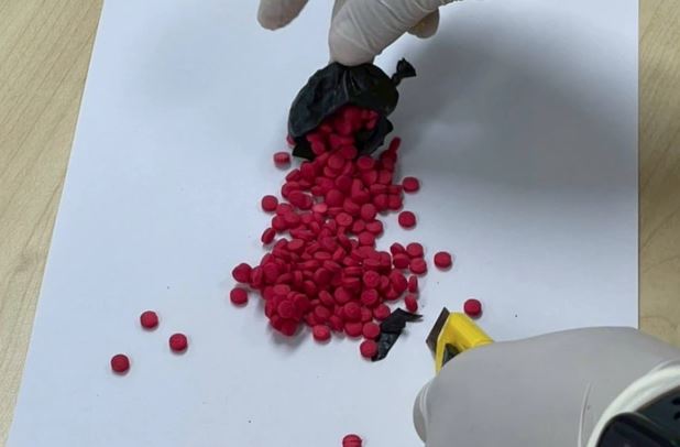 Người đàn ông 43 tuổi bất ngờ co giật tại sân bay, đi cấp cứu bác sĩ phát hiện "bí mật động trời"- Ảnh 2.