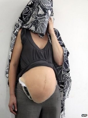 Kiểm tra "thai phụ" chửa vượt mặt, cảnh sát phát hiện bí mật động trời- Ảnh 2. Kiểm tra "thai phụ" chửa vượt mặt, cảnh sát phát hiện bí mật động trời- Ảnh 2.