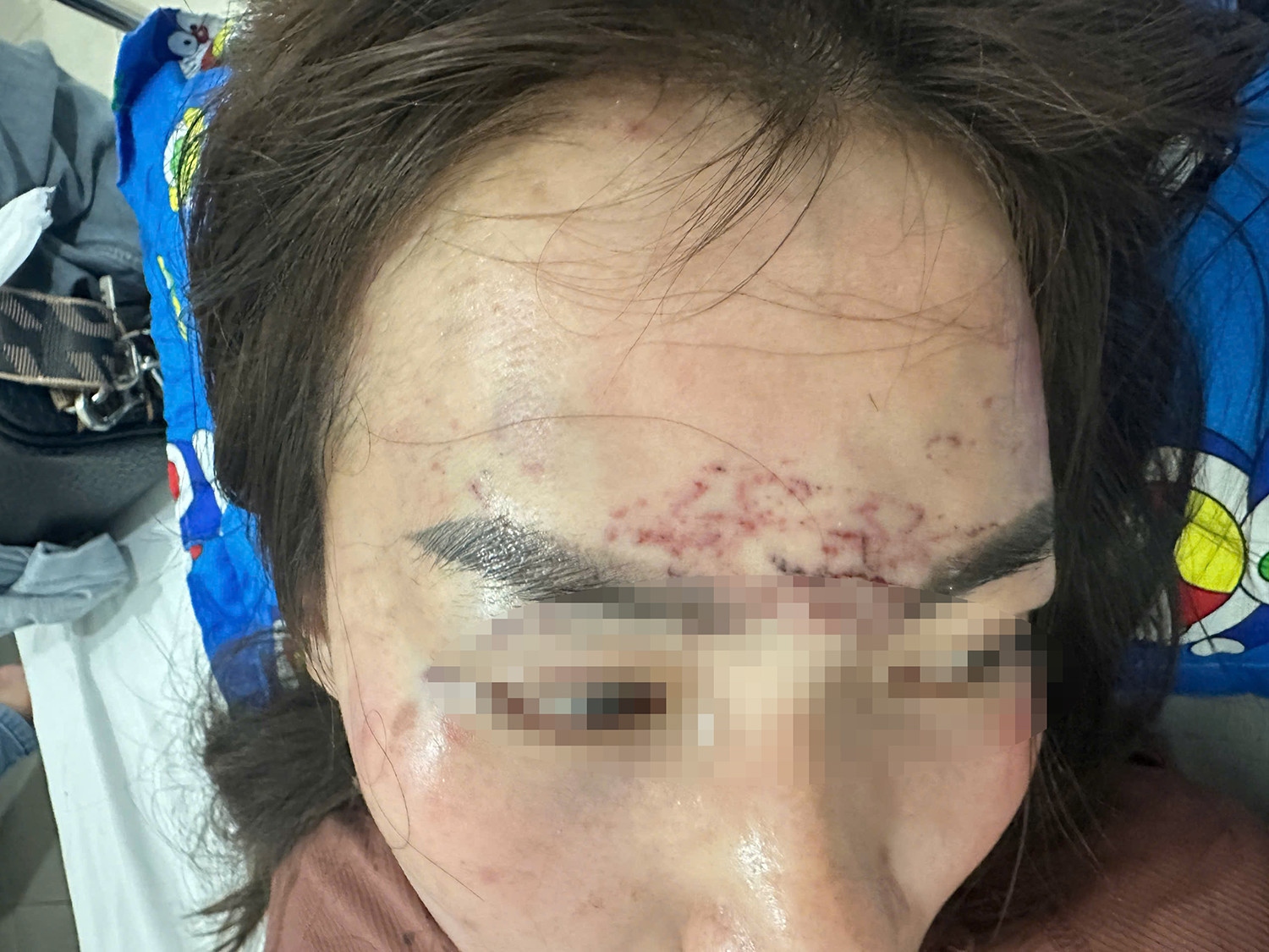 Diễn biến mới vụ người phụ nữ bị cắt tóc, xăm mặt ở Cà Mau- Ảnh 1. Diễn biến mới vụ người phụ nữ bị cắt tóc, xăm mặt ở Cà Mau- Ảnh 1.