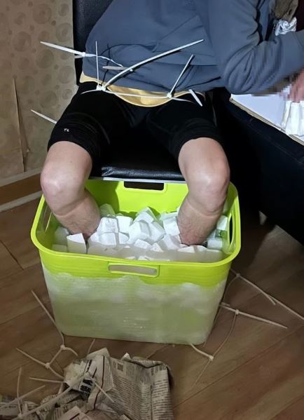 Nam sinh viên phải cắt cụt chân sau 10 tiếng ngâm đá khô, hé lộ âm mưu "động trời"- Ảnh 1. Nam sinh viên phải cắt cụt chân sau 10 tiếng ngâm đá khô, hé lộ âm mưu "động trời"- Ảnh 1.