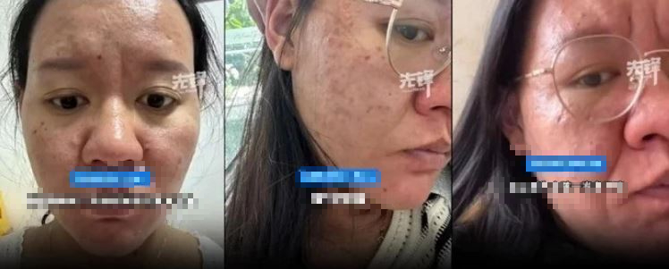 Người phụ nữ gây sốc vì gương mặt như bà lão khi mang thai- Ảnh 1. Người phụ nữ gây sốc vì gương mặt như bà lão khi mang thai- Ảnh 1.