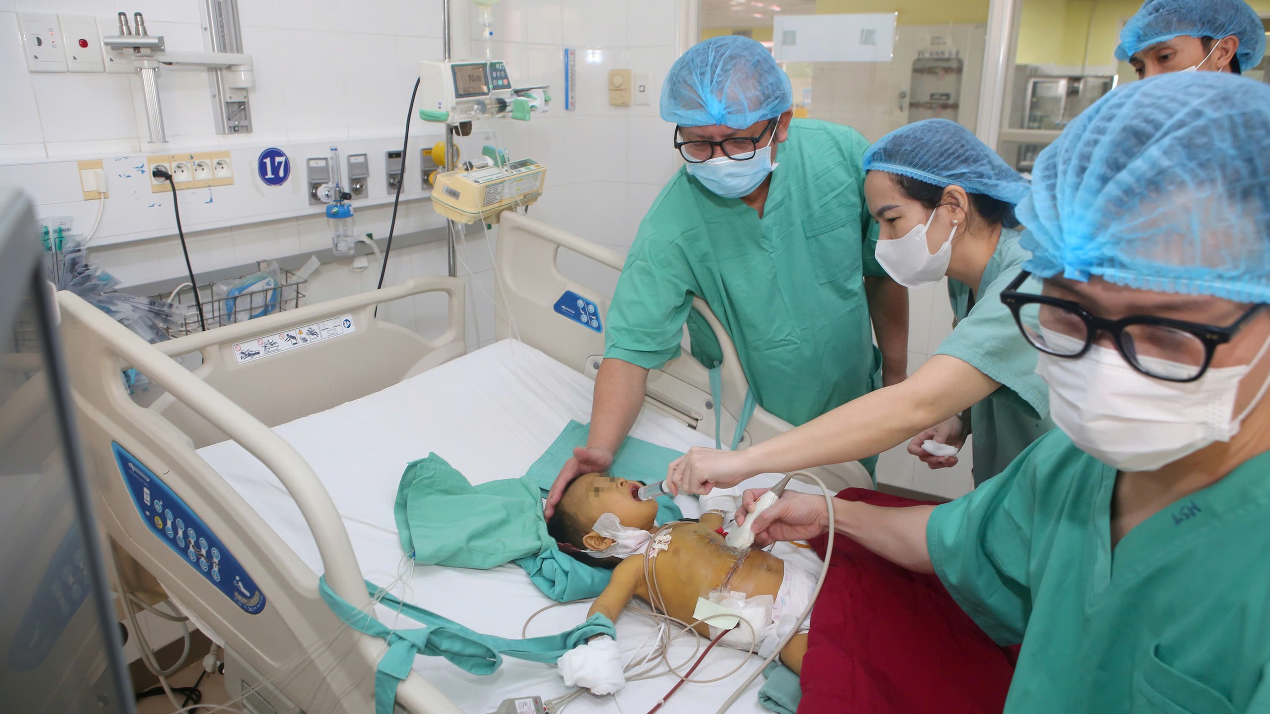 Hành trình hồi sinh ngoạn mục của bé 15 tháng tuổi ghép gan ở Huế- Ảnh 2. Hành trình hồi sinh ngoạn mục của bé 15 tháng tuổi ghép gan ở Huế- Ảnh 2.