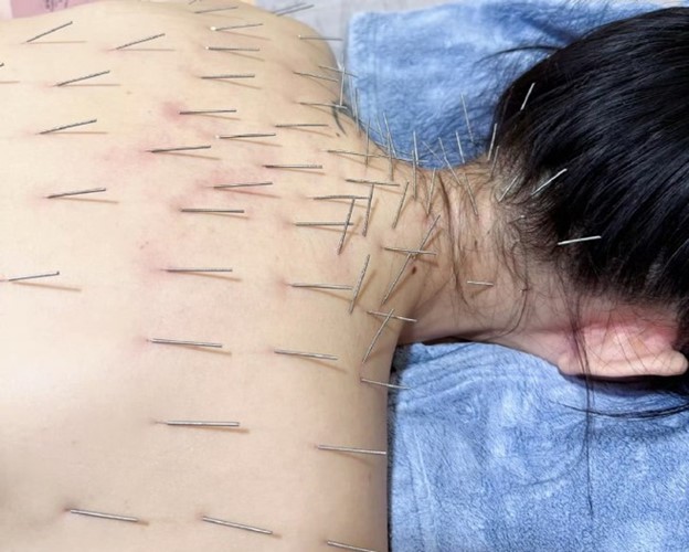 "Nữ hoàng phim thần tượng" gây sốt khi cắm hàng trăm chiếc kim khắp cơ thể- Ảnh 1. "Nữ hoàng phim thần tượng" gây sốt khi cắm hàng trăm chiếc kim khắp cơ thể- Ảnh 1.
