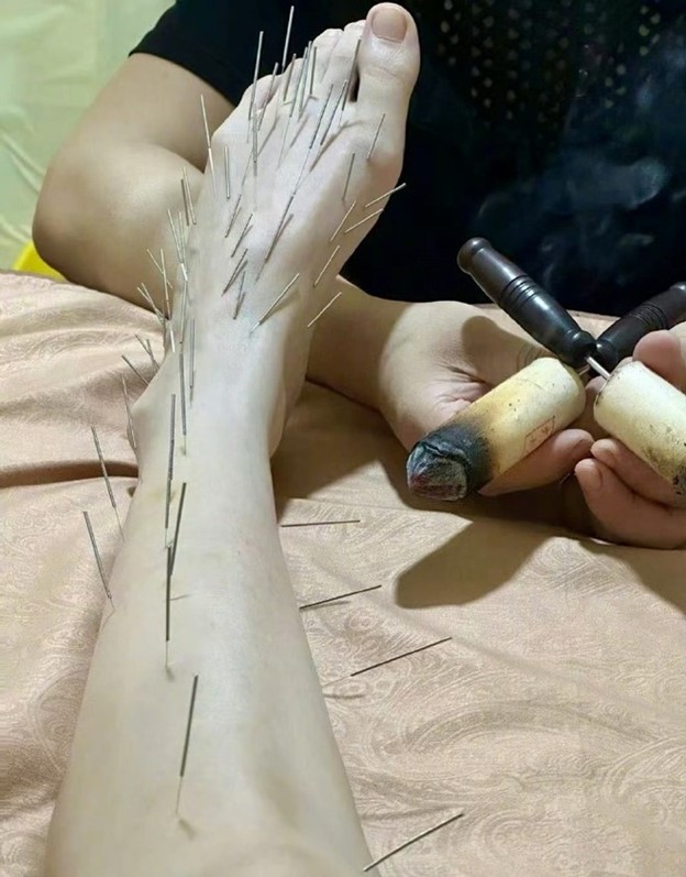 "Nữ hoàng phim thần tượng" gây sốt khi cắm hàng trăm chiếc kim khắp cơ thể- Ảnh 4. "Nữ hoàng phim thần tượng" gây sốt khi cắm hàng trăm chiếc kim khắp cơ thể- Ảnh 4.