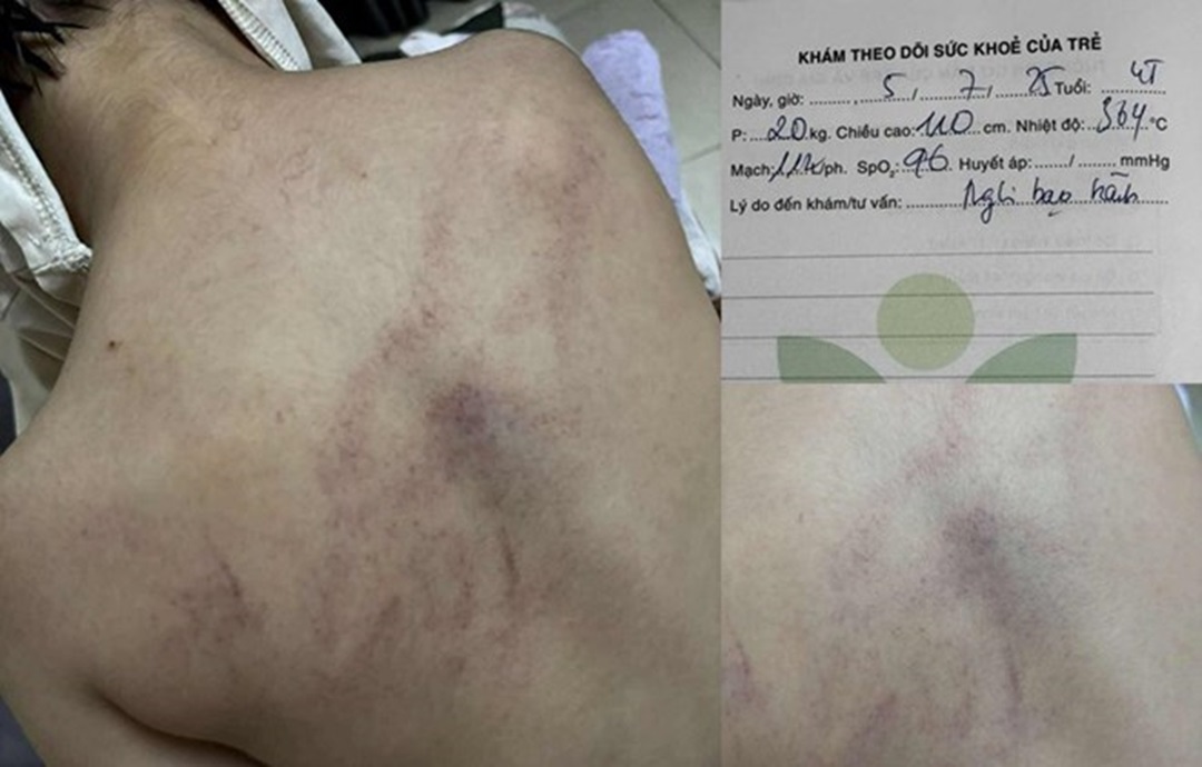 Vụ bé gái 4 tuổi bị đánh, ném vào tường ở Hà Nội: Cô giáo bạo hành nói gì? - Ảnh 1.