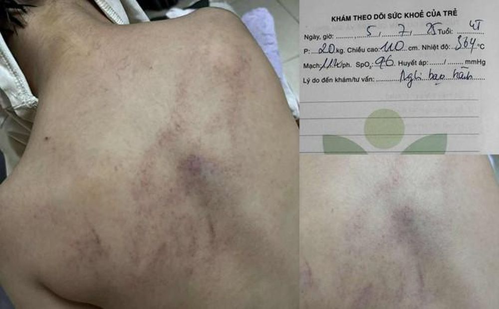 Cục Bà mẹ và Trẻ em phản hồi vụ cô giáo dốc ngược đầu trẻ, ném xuống giường - Ảnh 2.