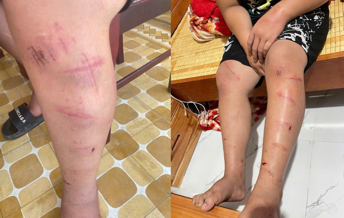 Xác minh thông tin nam sinh ở Huế bị người đàn ông xích chân rồi hành hung- Ảnh 1. Xác minh thông tin nam sinh ở Huế bị người đàn ông xích chân rồi hành hung- Ảnh 1.