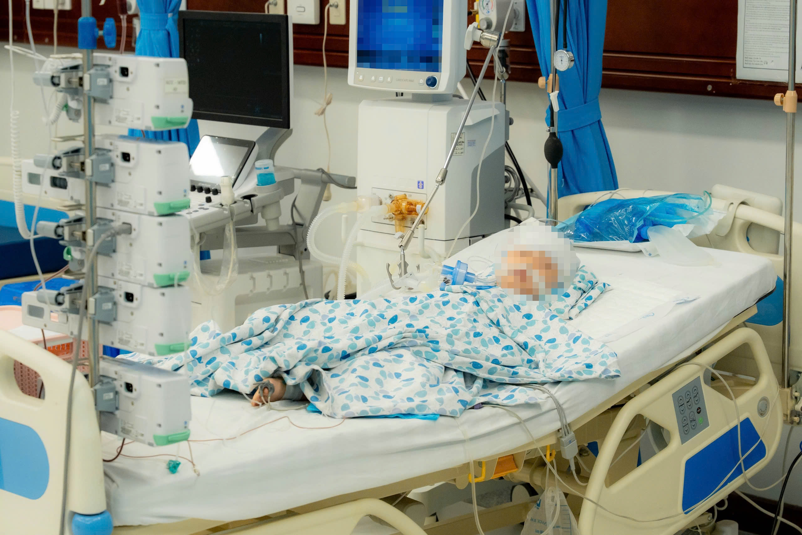 Vụ tài xế say rượu gây tai nạn liên hoàn: Bệnh nhi 4 tuổi đa chấn thương nặng- Ảnh 1.