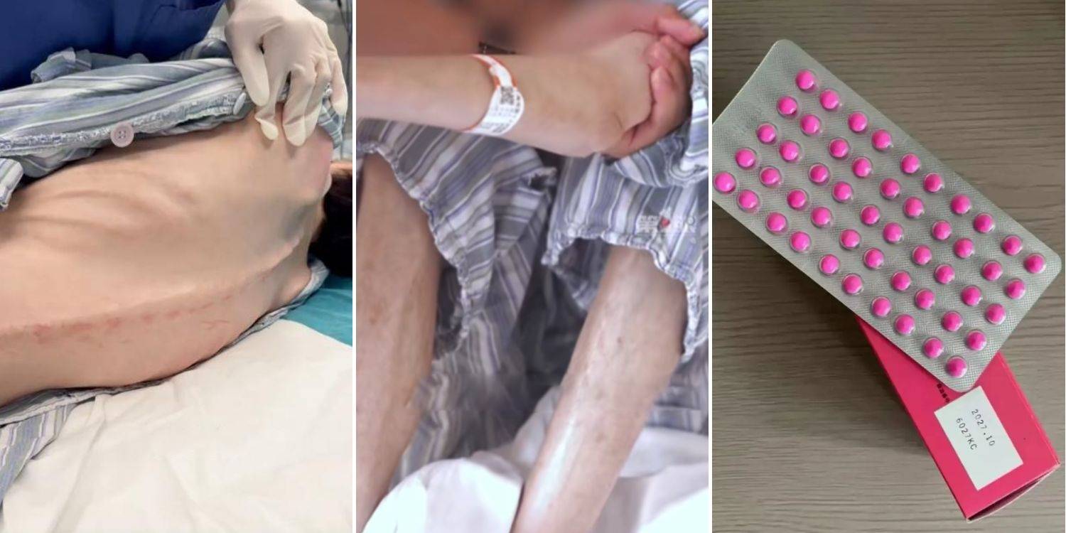 Uống 200 viên thuốc mỗi ngày để giảm cân, người phụ nữ nhập viện- Ảnh 1. Uống 200 viên thuốc mỗi ngày để giảm cân, người phụ nữ nhập viện- Ảnh 1.