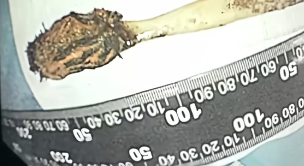 Khám cho nam thanh niên 29 tuổi, bác sĩ phát hiện "bí mật" đáng sợ - Ảnh 3.
