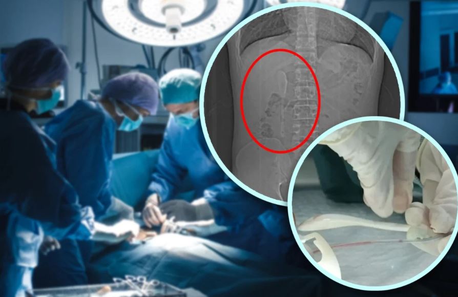 Khám cho nam thanh niên 29 tuổi, bác sĩ phát hiện "bí mật" đáng sợ - Ảnh 2.