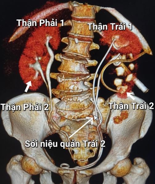 Khám cho người phụ nữ 65 tuổi, bác sĩ phát hiện sự thật bất ngờ - Ảnh 1.