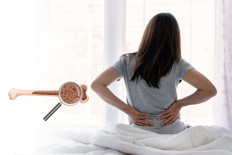 Loãng xương sau sinh: Mối nguy âm thầm nhưng có thể phòng ngừa hiệu quả - Ảnh 2.