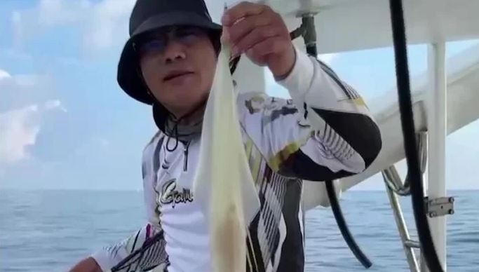 Ăn hải sản suốt 30 năm, đi khám, người đàn ông 64 tuổi sốc nặng trước thông báo của bác sĩ - Ảnh 1.