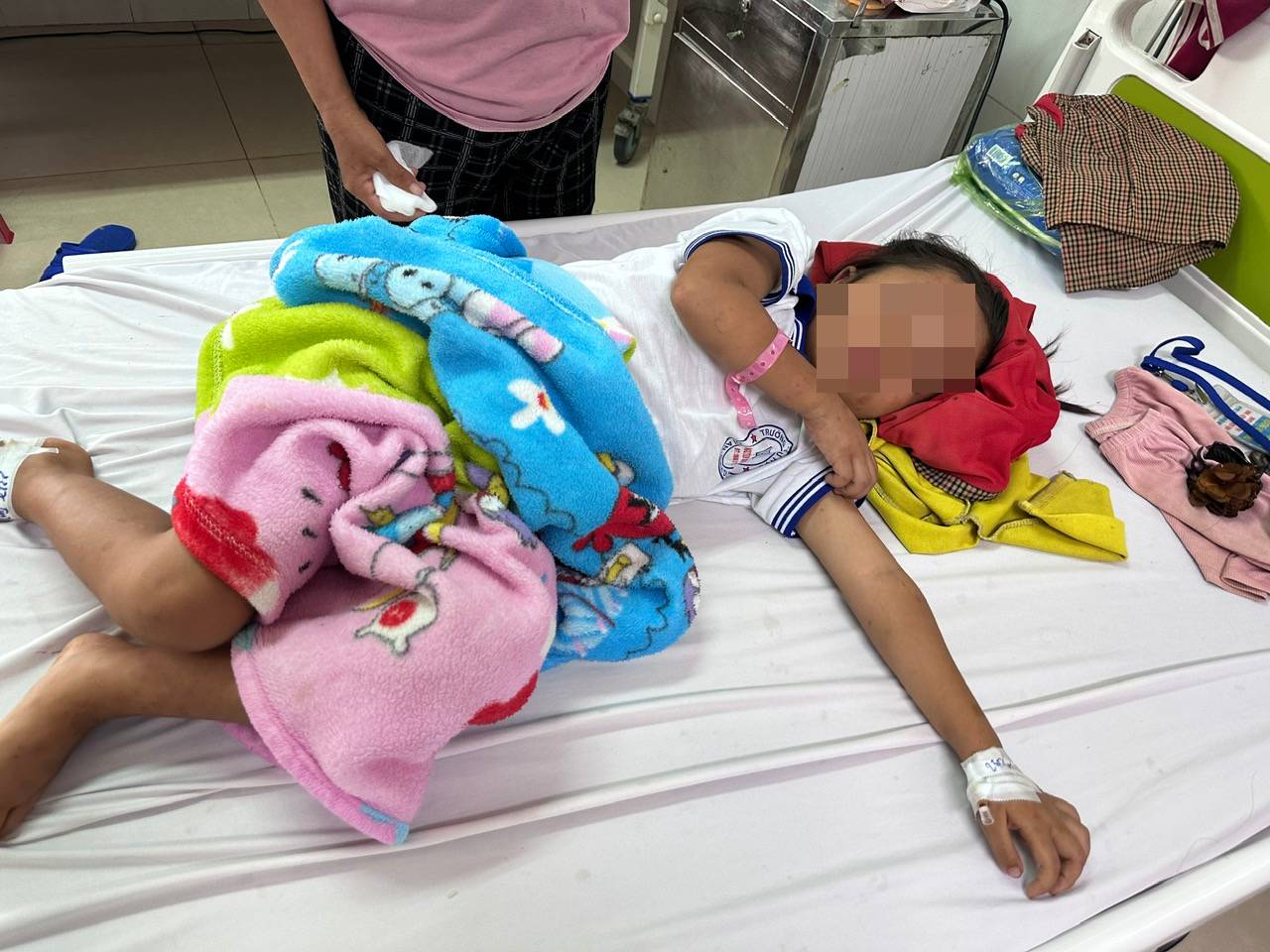 Cháu bé 7 tuổi nhập viện với 200 vết ong đốt gây bội nhiễm, tổn thương giác mạc  - Ảnh 2.