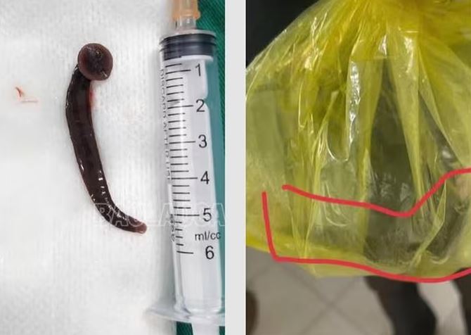 Người đàn ông gặp tai nạn hi hữu khi đang làm việc ngoài đồng- Ảnh 1. Người đàn ông gặp tai nạn hi hữu khi đang làm việc ngoài đồng- Ảnh 1.