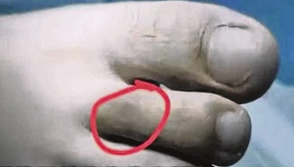 Đi bộ về khách sạn, cô gái 27 tuổi bị rắn cắn tử vong- Ảnh 2. Đi bộ về khách sạn, cô gái 27 tuổi bị rắn cắn tử vong- Ảnh 2.