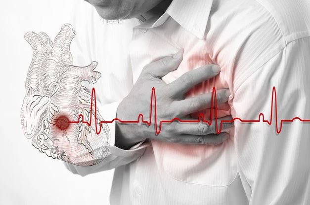 Đột tử và đột quỵ khác nhau thế nào, cách sơ cứu ra sao? - Ảnh 3.