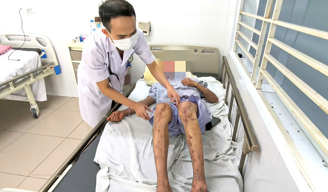 Nguy cơ dị ứng đe dọa sức khỏe người lao động từ silicon trong xây dựng- Ảnh 1.