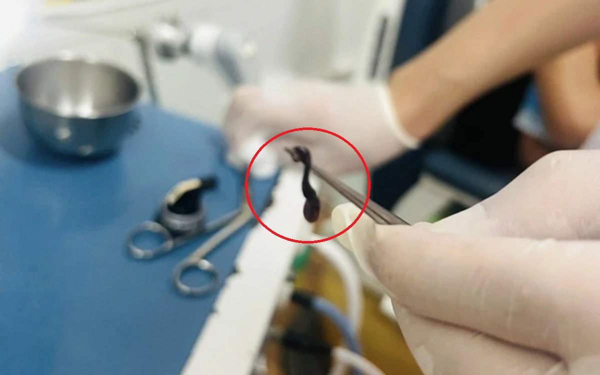 Người phụ nữ bụng to như mang bầu, đi khám, bác sĩ phát hiện "bí mật" đáng sợ - Ảnh 2.