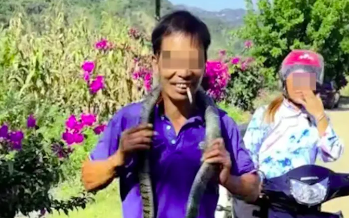 Đang ngủ ngon, người đàn ông 33 tuổi đau tai dữ dội, đến viện bác sĩ gắp ra thứ đáng sợ - Ảnh 2.