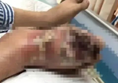 Uống 3 lon nước ngọt mỗi ngày, người đàn ông 31 tuổi nhận "kết cục đáng sợ" - Ảnh 2.