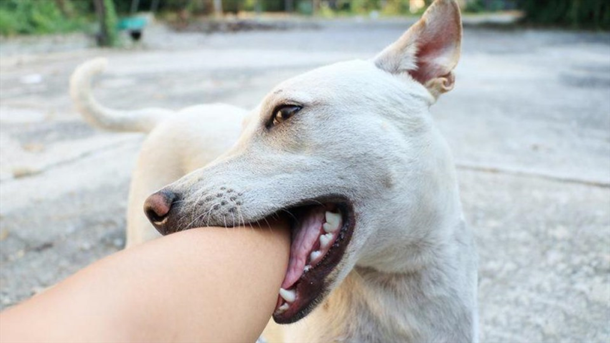 Bé gái 11 tuổi không còn cơ hội sống sau vài ngày chó nuôi chết, bác sĩ chỉ cách phòng tránh - Ảnh 1.