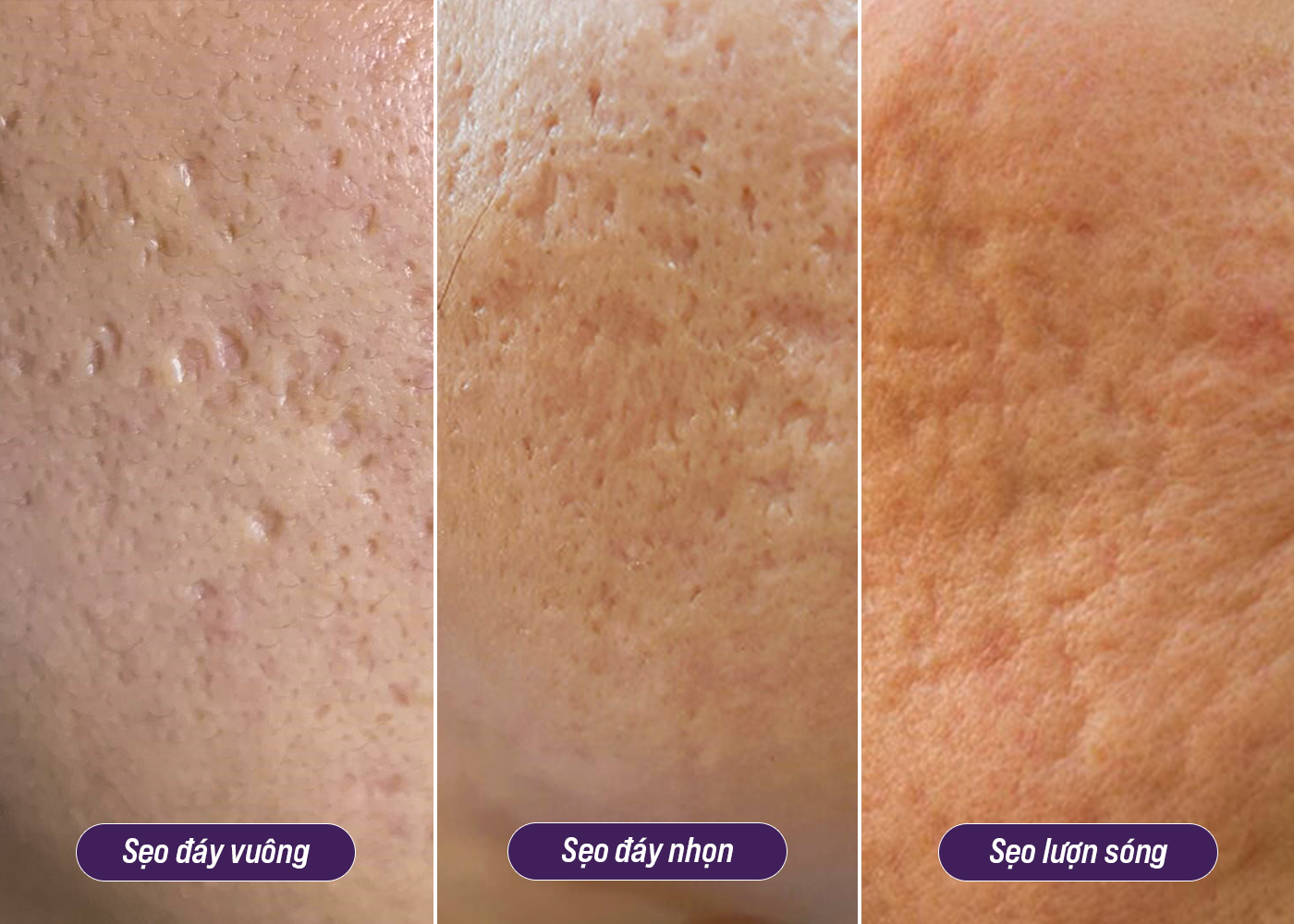 Bác sĩ Da liễu Nguyễn Thế Anh – “Bàn tay vàng” trong ứng dụng công nghệ điều trị sẹo Pulse Scar an toàn, hiệu quả - Ảnh 1.
