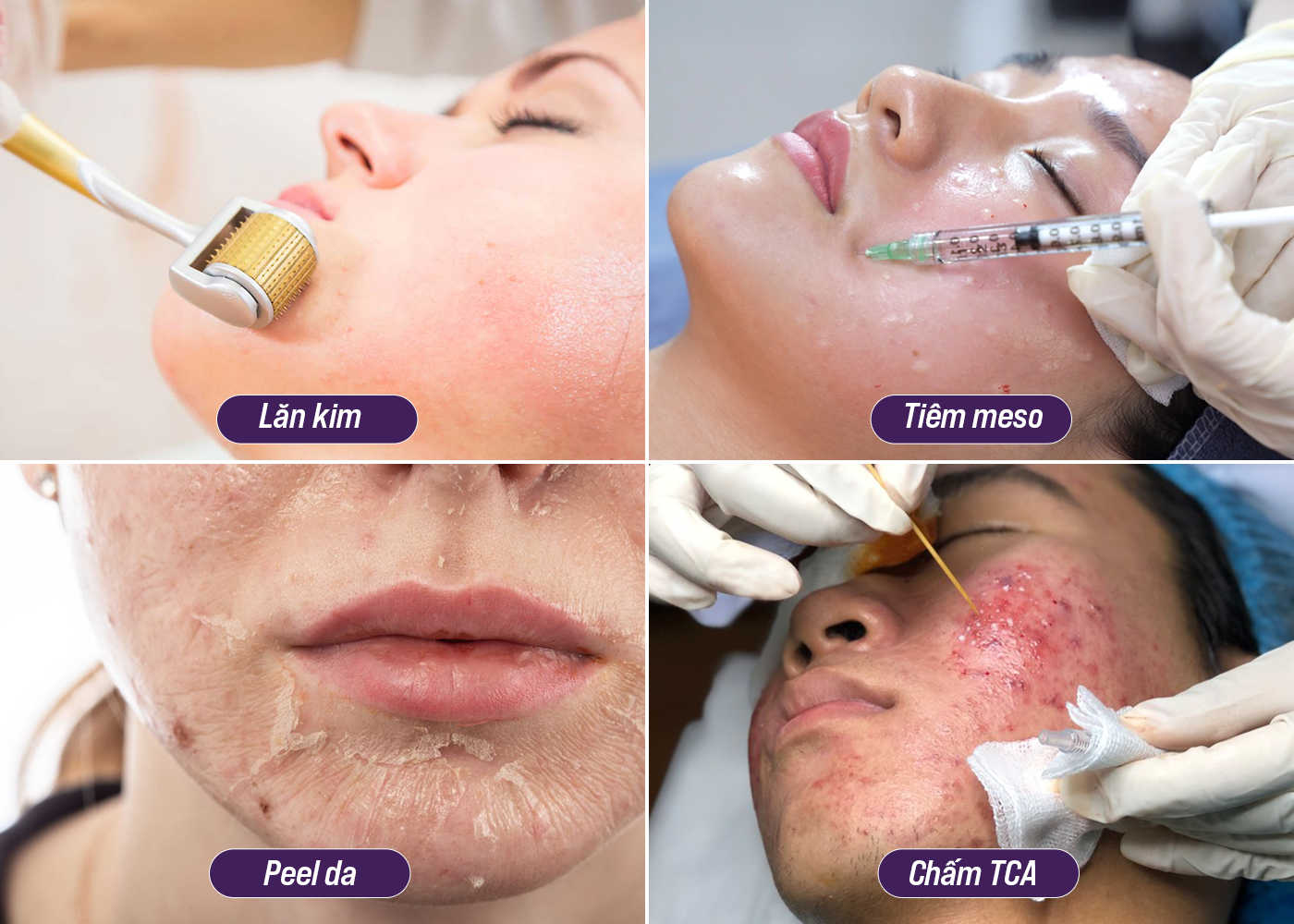 Bác sĩ Da liễu Nguyễn Thế Anh – “Bàn tay vàng” trong ứng dụng công nghệ điều trị sẹo Pulse Scar an toàn, hiệu quả - Ảnh 2.