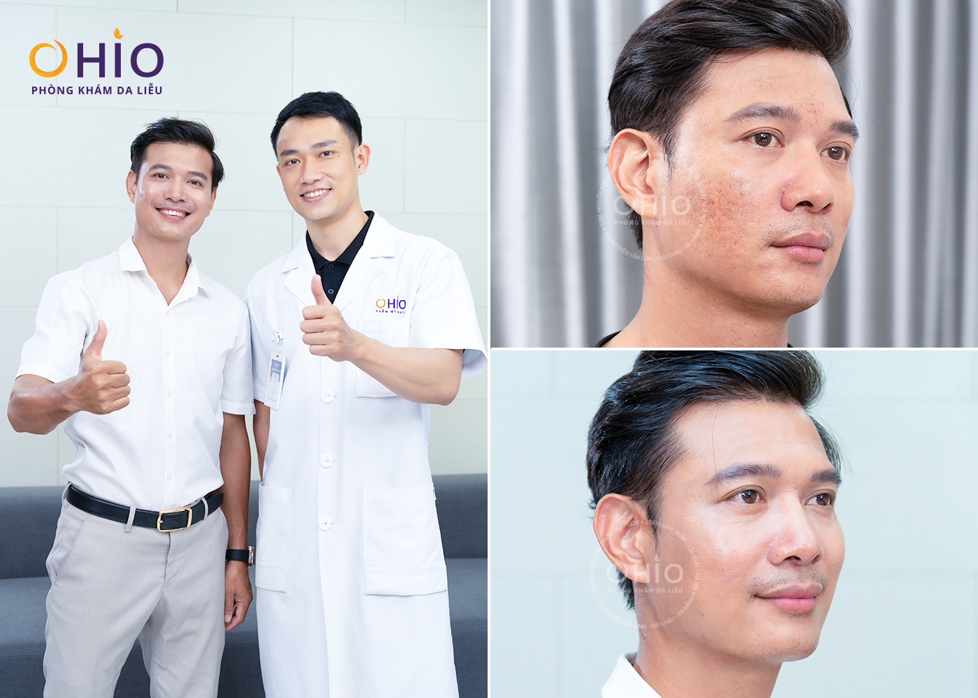 Bác sĩ Da liễu Nguyễn Thế Anh – “Bàn tay vàng” trong ứng dụng công nghệ điều trị sẹo Pulse Scar an toàn, hiệu quả - Ảnh 4.