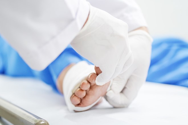Khám chân cho người đàn ông 45 tuổi, bác sĩ sốc nặng khi phát hiện "bí mật đáng sợ" - Ảnh 1.
