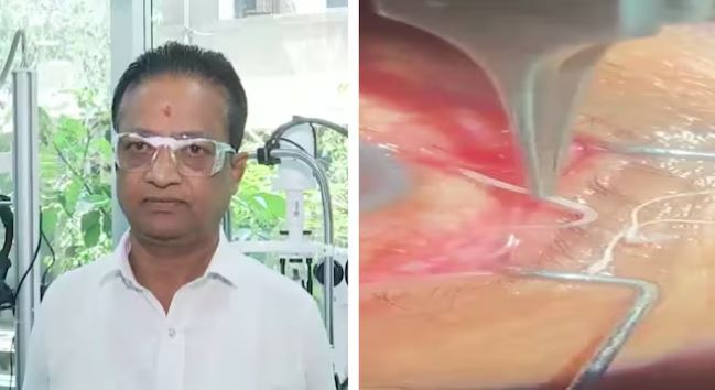 Người đàn ông 60 tuổi đau nhói ở mắt, bác sĩ sốc nặng khi phát hiện "thứ đáng sợ" bên trong- Ảnh 1.
