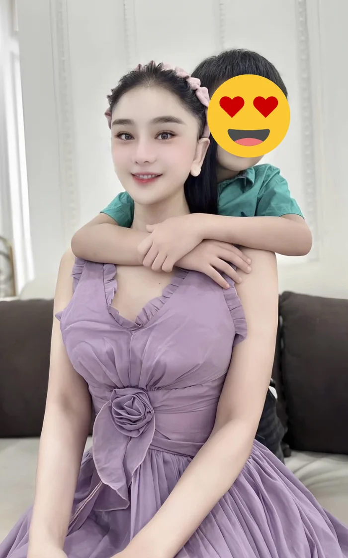 Nhan sắc Lâm Khánh Chi sau 10 ngày tiếp tục can thiệp "dao kéo" - Ảnh 3.