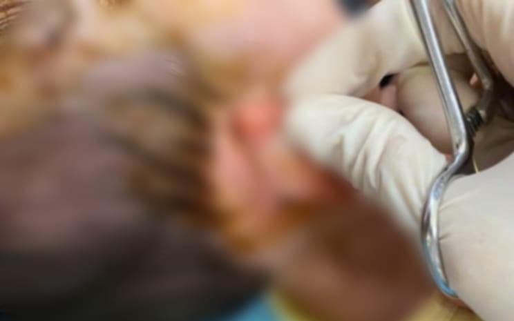 Người đ&agrave;n &ocirc;ng 51 tuổi tử thương t&acirc;m sau khi bị ch&oacute; "lạ" cắn - Ảnh 2.