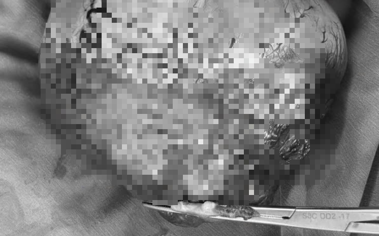 Đi si&ecirc;u &acirc;m, người đ&agrave;n &ocirc;ng sốc nặng khi thấy con vật lạ "bơi" trong bụng m&igrave;nh - Ảnh 2.