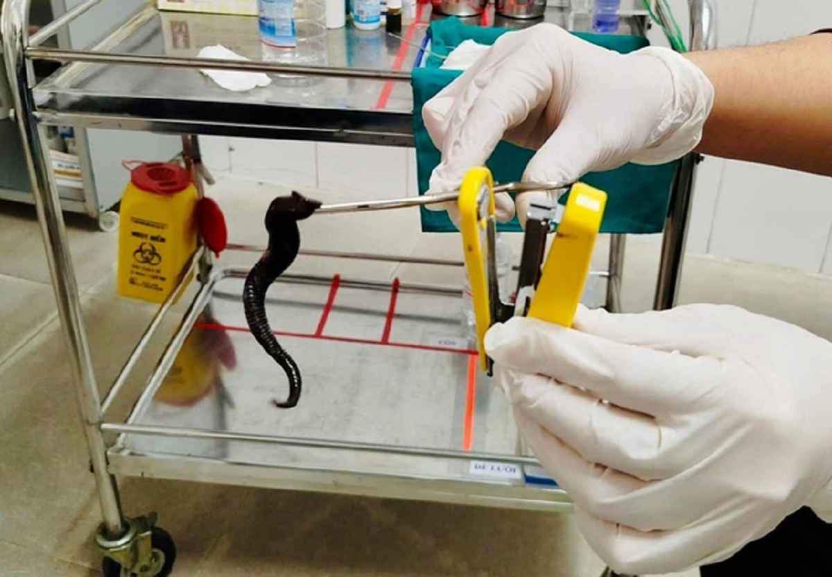 Đi khám, người đàn ông sốc nặng khi thấy thứ đáng sợ trong mũi mình- Ảnh 1.