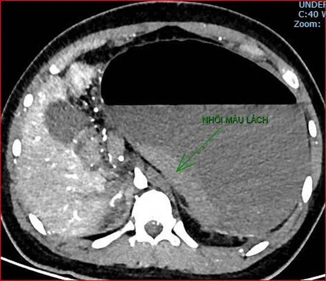 Ca bệnh tử vong gây dư luận trái chiều: Bệnh viện thông tin sự việc- Ảnh 3.