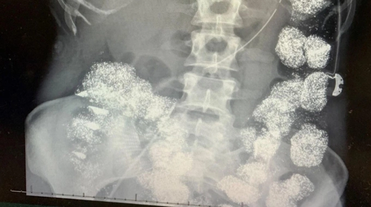 Muốn ly hôn và hưởng tiền bảo hiểm 26 tỷ đồng, bác sĩ Mỹ đầu độc vợ - Ảnh 2.