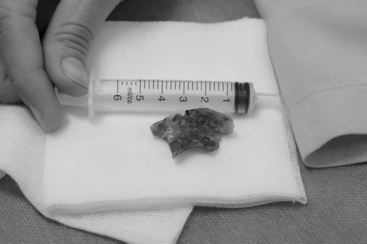 Nửa đêm đau họng, người phụ nữ 55 tuổi sốc phát hiện bí mật "đáng sợ" - Ảnh 1.