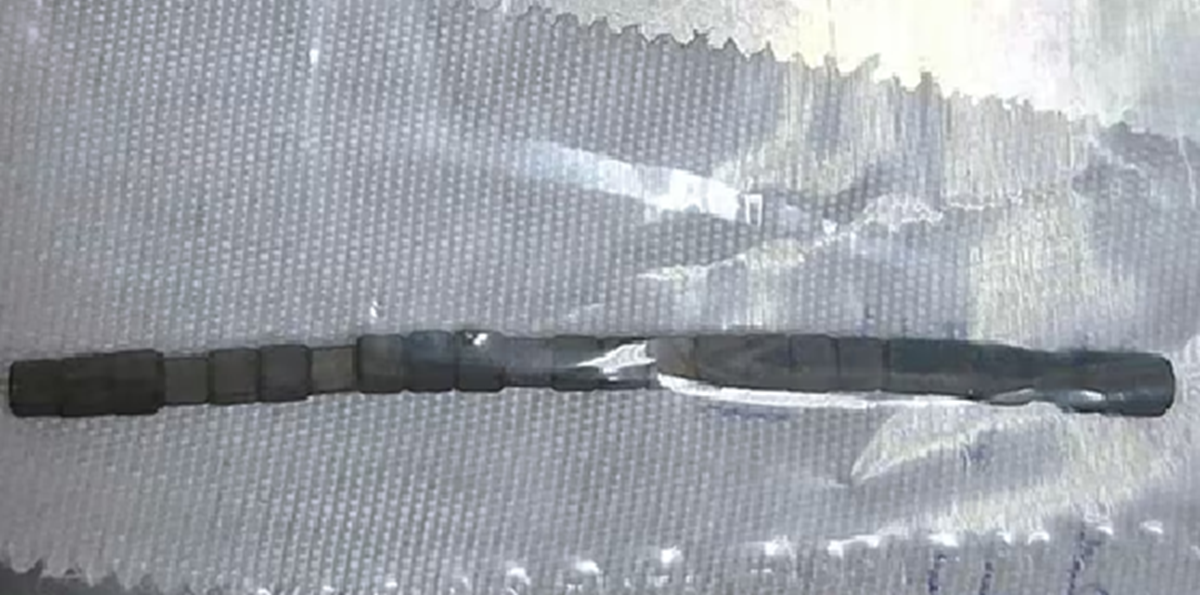 Bé trai hơn 2 tuổi "bụng cứng như đá", bác sĩ phát hiện bí mật "đáng sợ" - Ảnh 1.