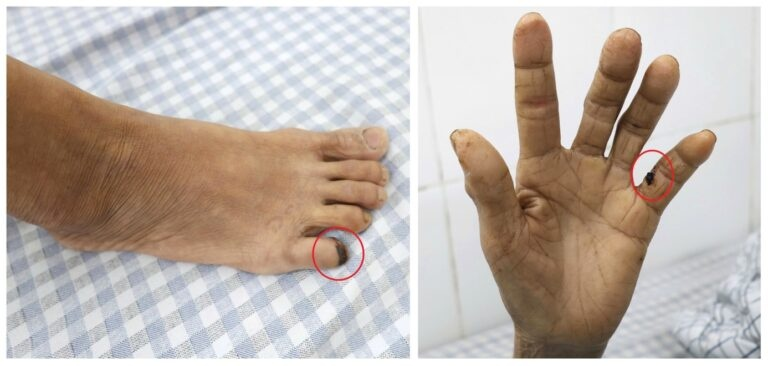 Người phụ nữ 60 tuổi "cứng hàm" vì bị gà đá - Ảnh 1.