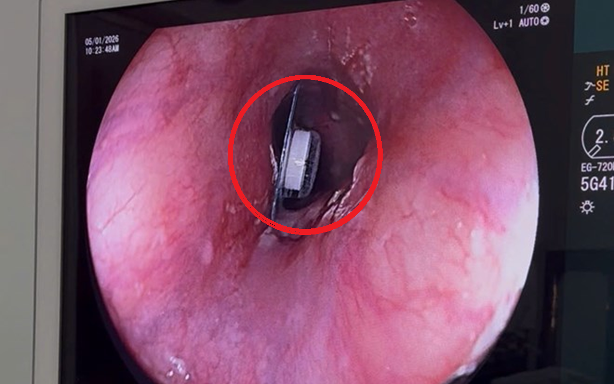 Đang đứng "h&oacute;ng chuyện", người phụ nữ bị con vật quen thuộc tấn c&ocirc;ng nguy kịch d&ugrave; đ&atilde; nhảy xuống ao - Ảnh 2.