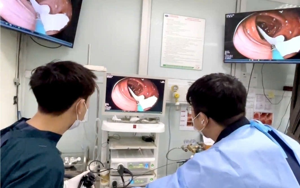 Người đàn ông 35 tuổi sốc nặng khi thấy ký sinh trùng "khổng lồ" đang sống trong ruột - Ảnh 1.