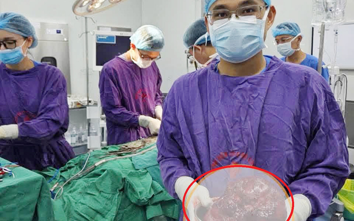 Bé trai 4 tuổi ngứa mắt, mẹ sốc khi bác sĩ gắp ra thứ "đáng sợ" bên trong - Ảnh 2.