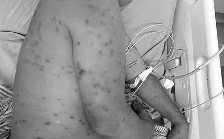 Bị hơn 300 con ong đốt, người đàn ông 62 tuổi nguy kịch - Ảnh 1.