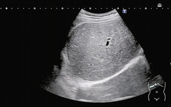 Hơn 1,2 triệu vi&ecirc;n sủi chứa chất bảo quản vượt ngưỡng 33 lần: Nguy cơ với sức khỏe ra sao? - Ảnh 2.