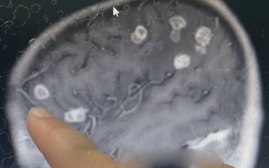 Người đàn ông bụng "cứng như đá" 2 tuần, bác sĩ sốc khi phát hiện bí mật "đáng sợ" - Ảnh 2.