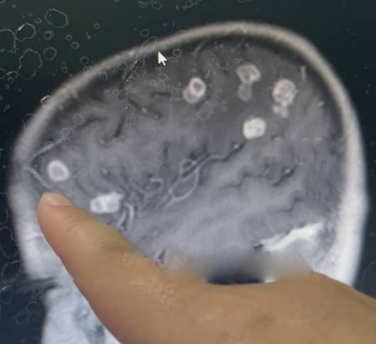 Bé gái sốt liên tục 17 ngày, bác sĩ sốc nặng khi phát hiện "bí mật" đáng sợ- Ảnh 1. Bé gái sốt liên tục 17 ngày, bác sĩ sốc nặng khi phát hiện "bí mật" đáng sợ- Ảnh 1.