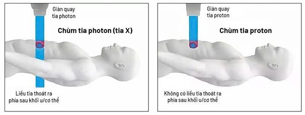 Việt Nam trở th&agrave;nh nước ch&acirc;u &Aacute; đầu ti&ecirc;n sở hữu &ldquo;si&ecirc;u m&aacute;y&rdquo; xạ trị proton thế hệ mới nhất - Ảnh 3.