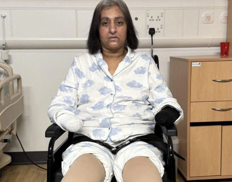 Cụ &ocirc;ng 74 tuổi hoang mang v&igrave; tiểu ra ph&acirc;n - Ảnh 2.